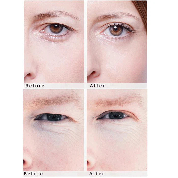 2 x 32 Patches Upper Eyelid Lifting Tape W7685